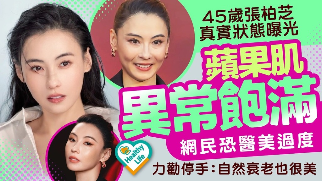 張柏芝｜45歲張柏芝真實狀態曝光蘋果肌異常飽滿 網民恐醫美過度力勸停手：自然衰老也很美