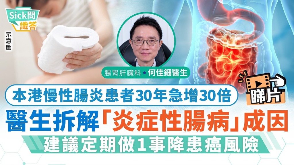 Sick問識答｜本港慢性腸炎患者30年急增30倍 醫生拆解「炎症性腸病」成因 建議定期做1事降患癌風險