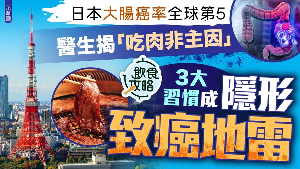 致癌危機｜日本大腸癌發生率全球第5 醫生揭「吃肉非主因」 3大習慣成隱形致癌地雷
