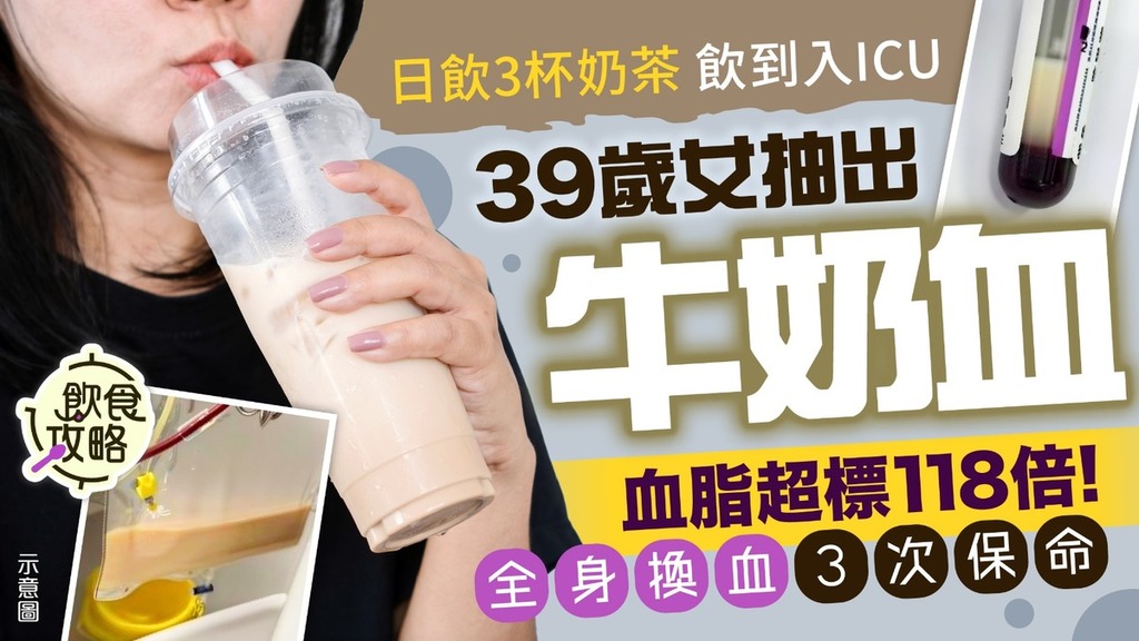飲食危機｜39歲女子日飲3杯奶茶入ICU 抽血驚現「牛奶血」全身換血3次保命