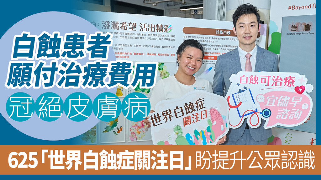 白蝕患者願付治療費用冠絕皮膚病 625「世界白蝕症關注日」盼提升公眾認識