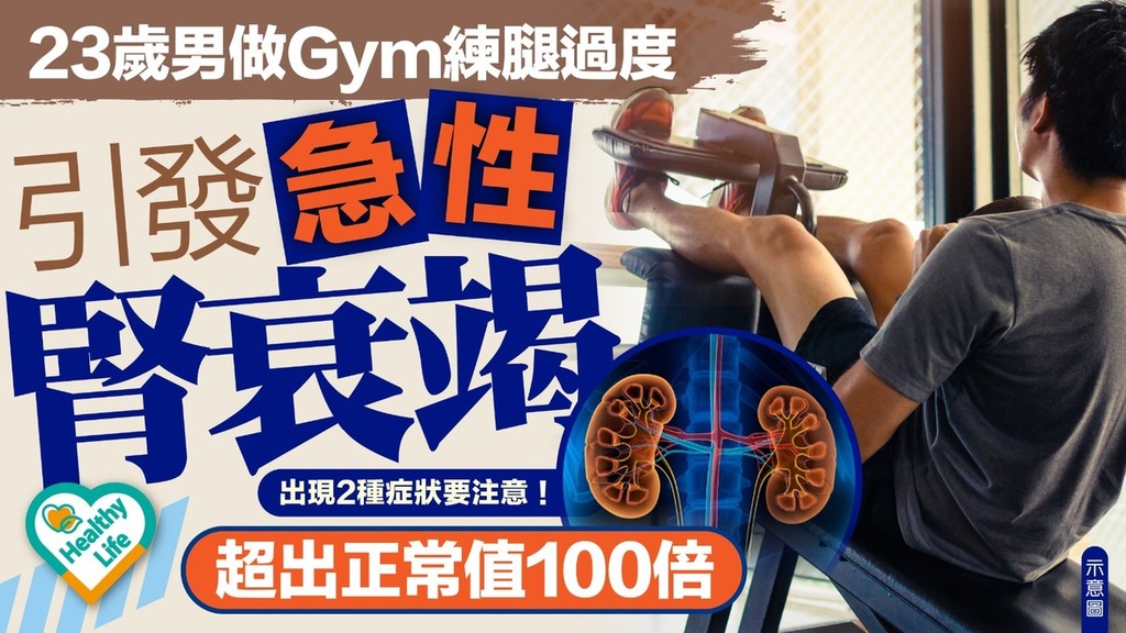 腎臟健康｜23歲男做Gym練腿過度引發急性腎衰竭 超出正常值100倍 出現2種症狀要注意