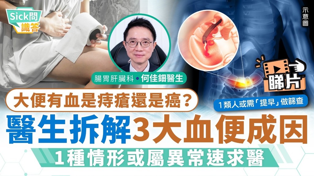 Sick問識答｜大便有血是痔瘡還是癌？ 醫生拆解3大血便成因 1種情形或屬異常速求醫