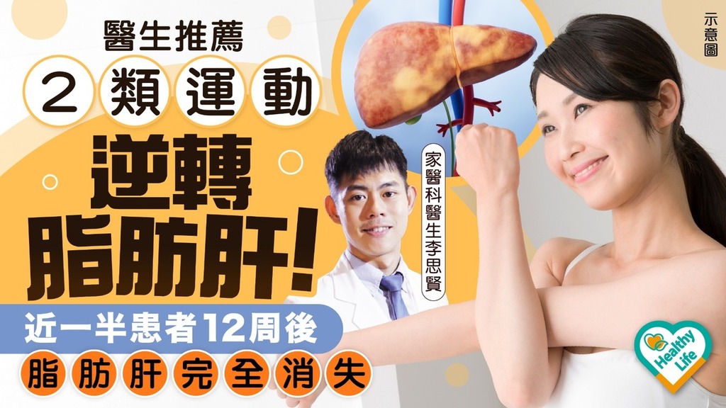 脂肪肝｜醫生推薦2類運動逆轉脂肪肝！ 近一半患者12周後脂肪肝完全消失