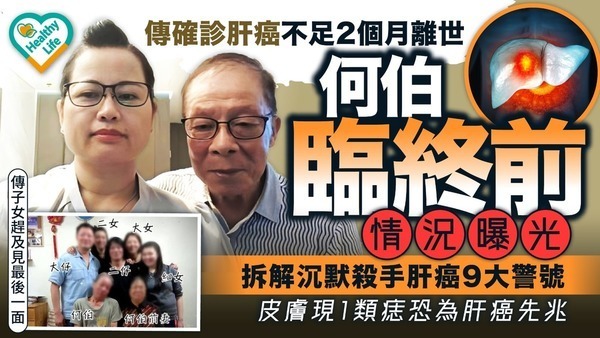 肝癌警號｜何伯臨終前情況曝光 傳確診肝癌不足2個月離世【附肝癌9大警號】