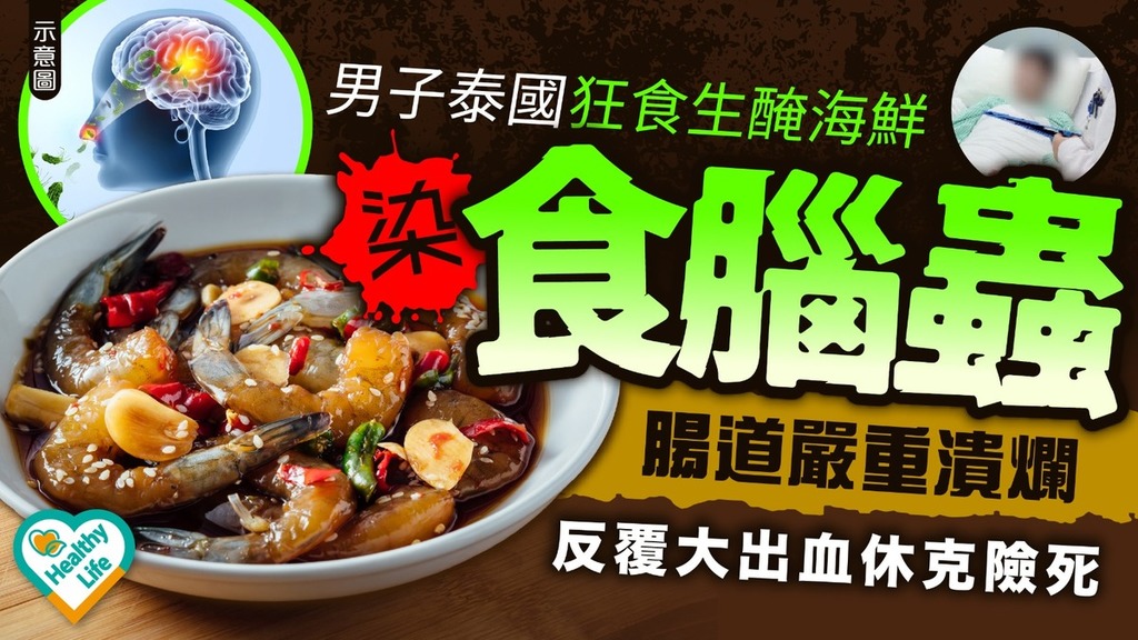 食腦蟲｜男子泰國狂食生醃海鮮染「食腦蟲」腸道嚴重潰爛 反覆大出血休克險死