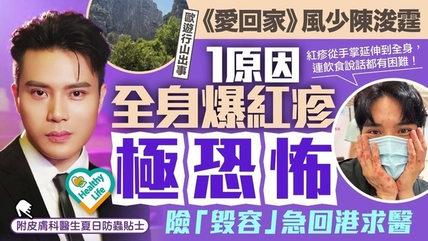 陳浚霆｜《愛回家》風少陳浚霆歐遊行山出事 1原因全身爆紅疹極恐怖 險「毀容」急回港求醫【附皮膚科醫生夏日防蟲貼士】