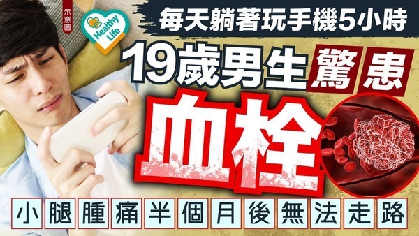 血管健康｜19歲男生每天躺著玩手機5小時血栓 小腿腫痛半個月後無法走路【附3招自測血栓風險】