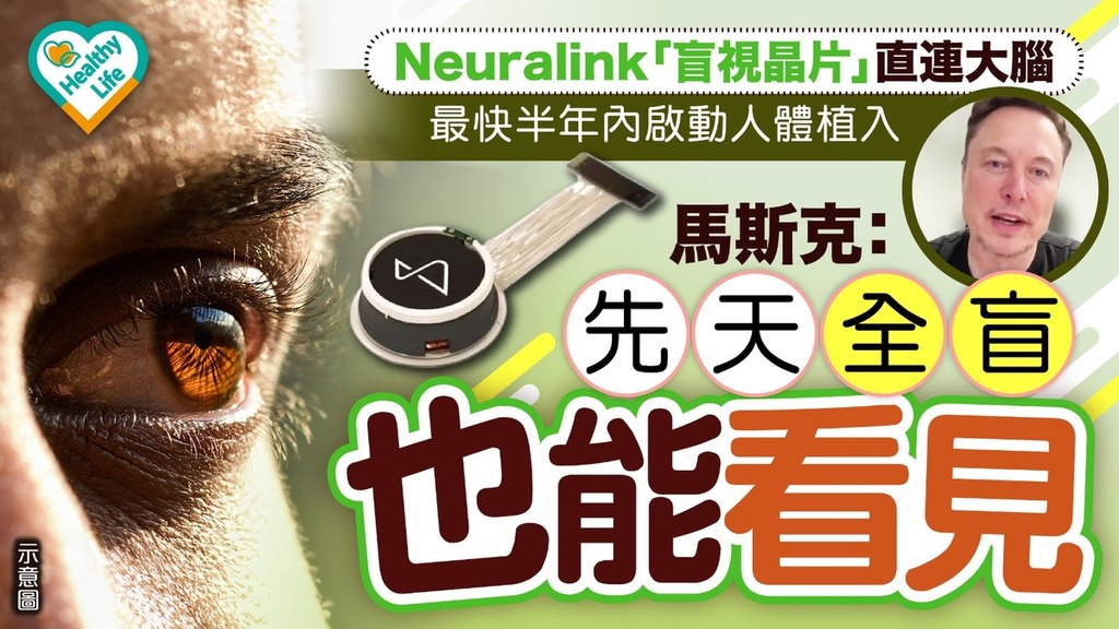 醫療突破︱Neuralink「盲視晶片」直連大腦最快半年內啟動人體植入 馬斯克：先天全盲也能看見