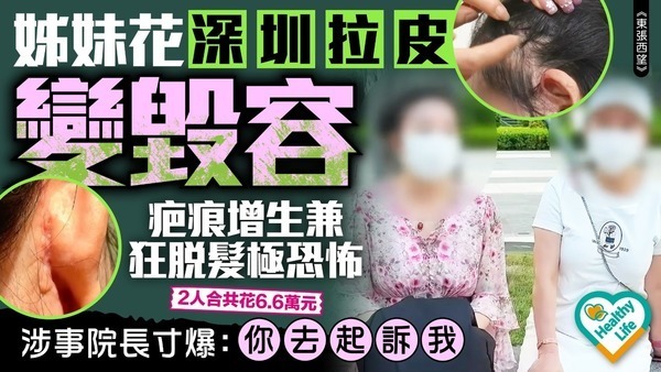 東張西望丨姊妹花深圳拉皮變毀容 疤痕增生兼狂脫髮極恐怖 涉事院長寸爆：你去起訴我