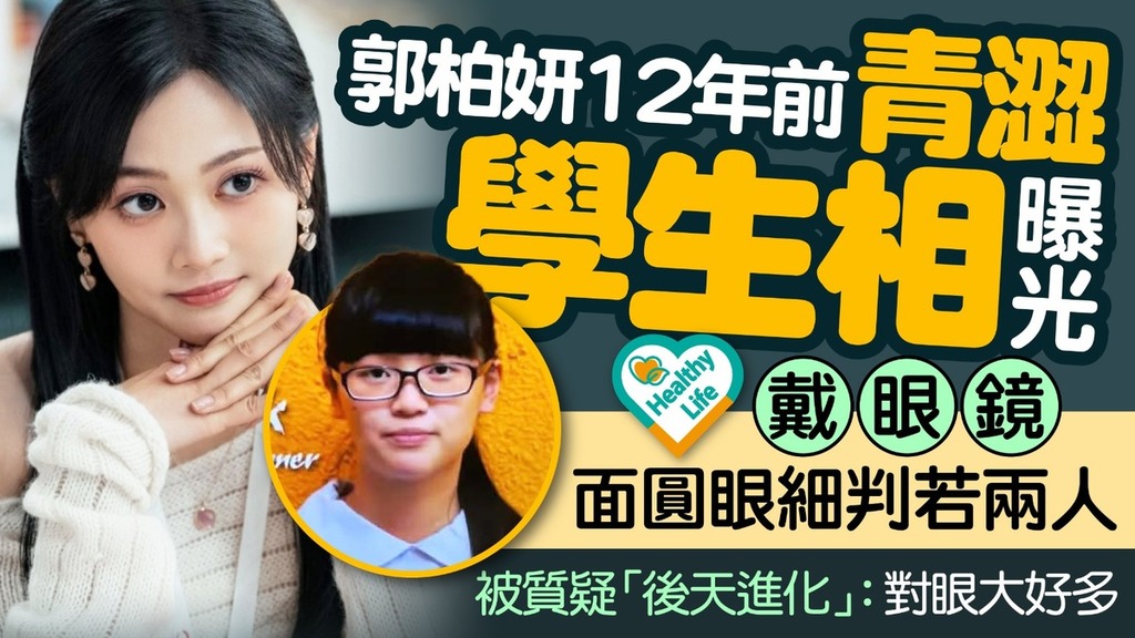 郭柏妍｜郭柏妍12年前青澀學生相曝光 戴眼鏡面圓眼細判若兩人被質疑「後天進化」：對眼大好多