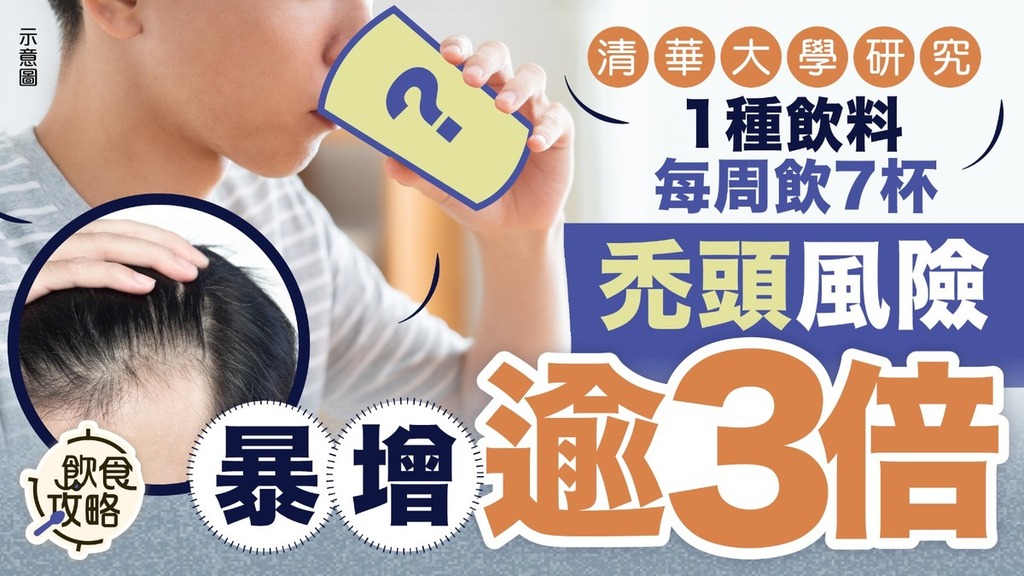 脫髮危機｜清華大學研究揭1種飲料每周飲7杯 後生仔禿頭風險暴增逾3倍【附10大生髮食材】