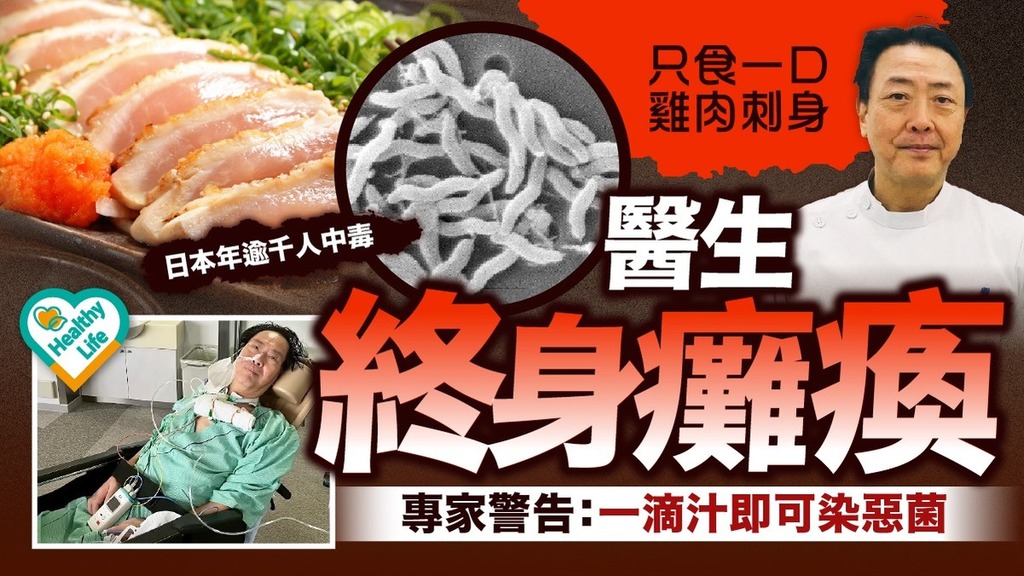 食用安全｜只食一口雞肉刺身醫生終身癱瘓 日本年逾千人中毒 專家警告：一滴汁即可染惡菌