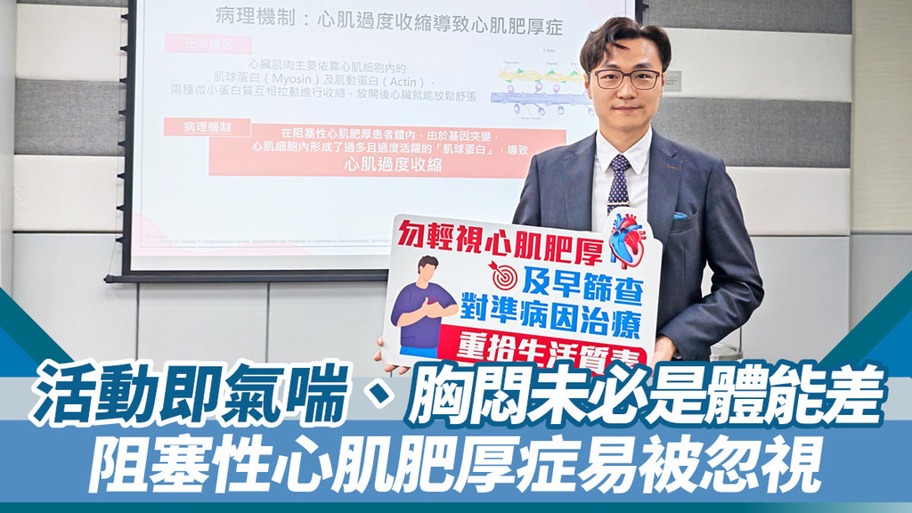 活動即氣喘、胸悶未必是體能差 阻塞性心肌肥厚症易被忽視