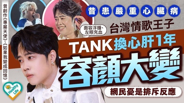 心臟病｜昔患嚴重心臟病 台灣情歌王子TANK換心肝1年容顏大變 網民憂是排斥反應