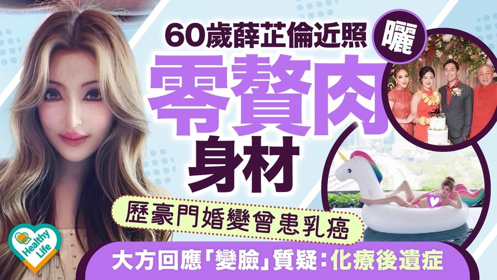 薛芷倫︱60歲薛芷倫近照曬零贅肉身材 歷豪門婚變曾患乳癌大方回應「變臉」質疑：化療後遺症