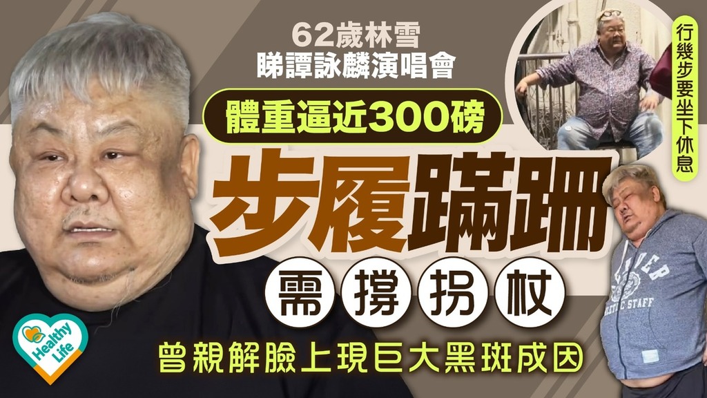 林雪健康︱62歲林雪睇譚詠麟演唱會 體重逼近300磅步履蹣跚需撐拐杖 曾親解臉上現巨大黑斑成因