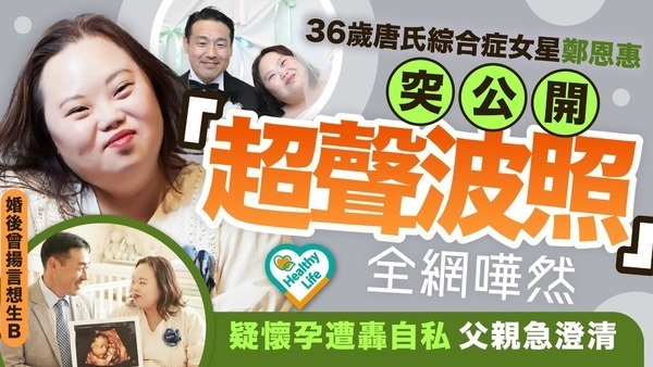 唐氏綜合症｜36歲唐氏綜合症女星鄭恩惠 突公開「超聲波照」全網嘩然 疑懷孕遭轟自私父親急澄清