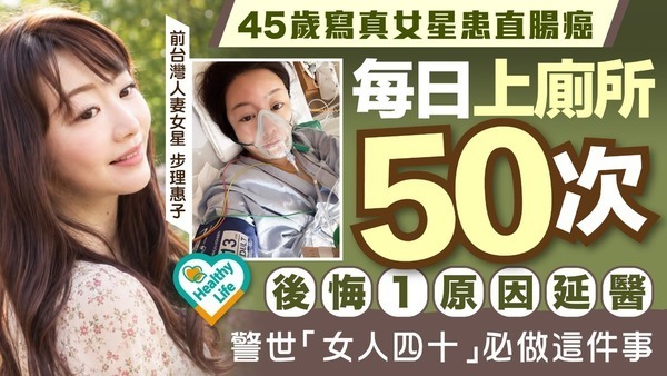 直腸癌︱45歲寫真女星患直腸癌術後每日去50次廁所 後悔1原因延醫 警世「女人四十」必做1件事