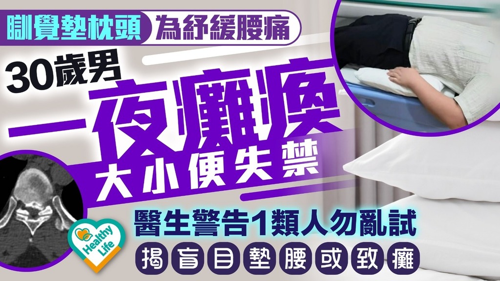腰椎健康｜瞓覺墊枕頭為紓緩腰痛30歲男一夜癱瘓大小便失禁 醫生警告1類人勿亂試揭盲目墊腰或致癱