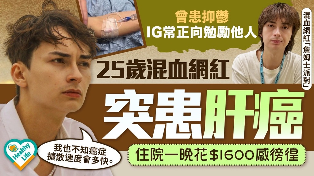 肝癌｜25歲混血網紅「詹姆士派對」驚爆患肝癌2期 醫藥費高昂人生計劃全打亂 曾陷抑鬱如今再患癌：很焦慮很徬徨