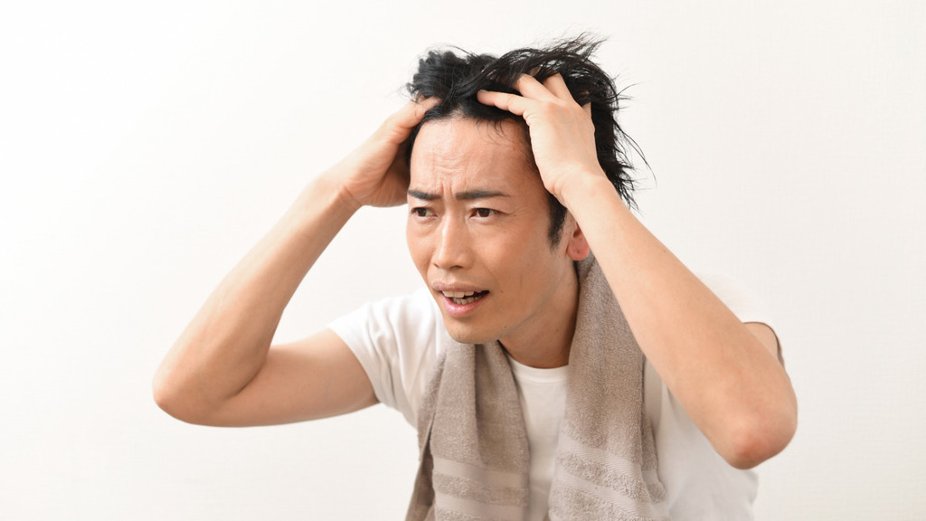 脫髮危機｜研究揭1種睡姿恐致「髮線後移」 專家揭脫髮元兇 教5招避免越瞓越禿