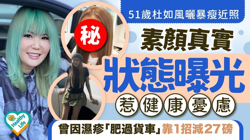 杜如風近況︱51歲杜如風曬暴瘦近照 素顏真實狀態曝光惹健康憂慮 曾因濕疹「肥過貨車」靠1招減27磅