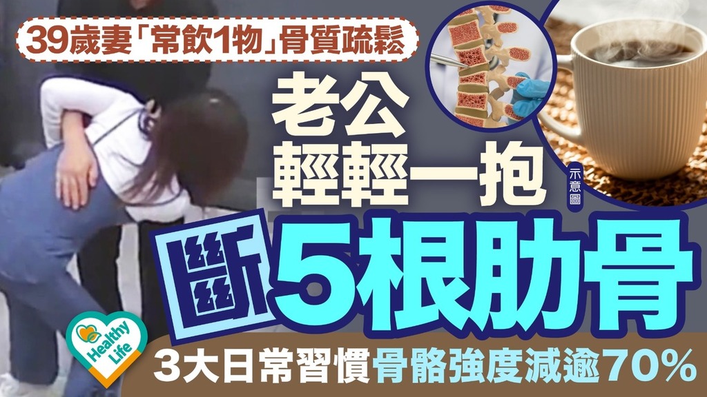 骨質疏鬆︱39歲妻「常飲1物」骨質疏鬆老公輕輕一抱斷5根肋骨 醫揭3大日常習慣骨骼強度減逾70%